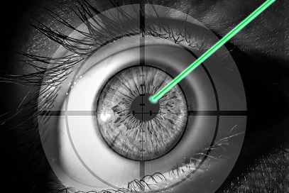 Can LASIK Fix Astigmatism Feature